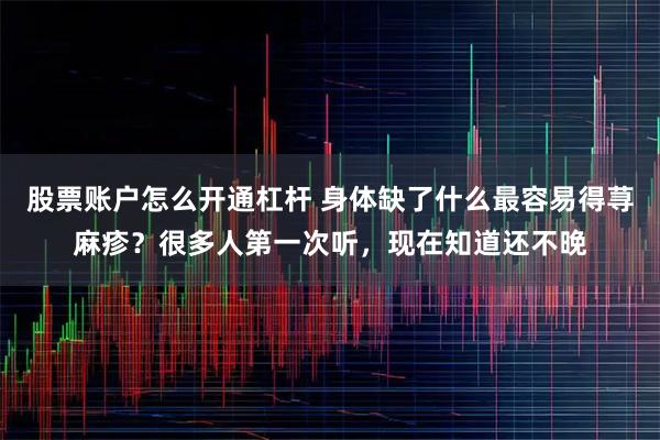股票账户怎么开通杠杆 身体缺了什么最容易得荨麻疹？很多人第一次听，现在知道还不晚